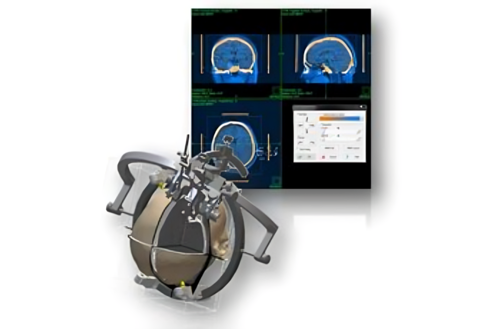 Orthopedic Surgery Image